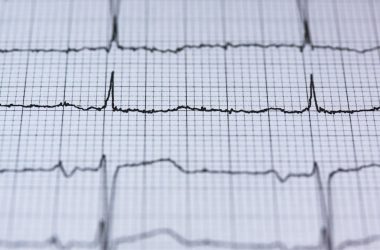 ecg, electrocardiogram, medicine, heartbeat, heart, frequency, curve, pulse, life, health, healthcare, circuit, examination, control examination, health check, rhythm, blood pressure, grid, expression, recording, ecg, ecg, ecg, ecg, ecg, electrocardiogram, heartbeat, heartbeat, frequency, blood pressure